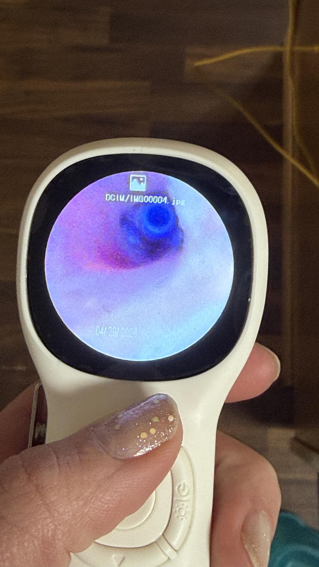 ScopeAround Digital Otoscope w/Built-in Screen, Manual-Focus Digital Otoscope with Light for Home Use, No App Needed, Easy Viewing for Everyday Ear Checks customer photo 1