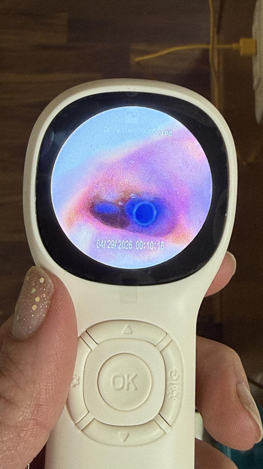 ScopeAround Digital Otoscope w/Built-in Screen, Manual-Focus Digital Otoscope with Light for Home Use, No App Needed, Easy Viewing for Everyday Ear Checks customer photo 2