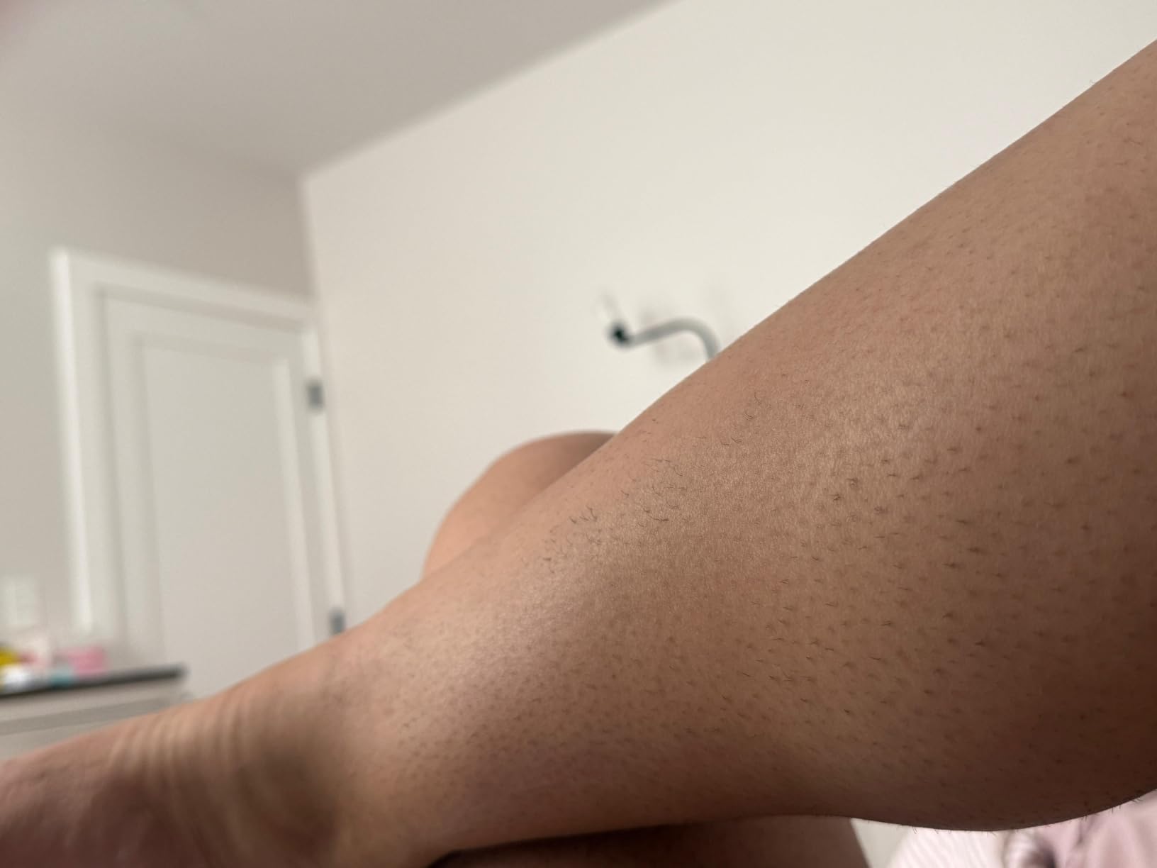 Philips Lumea IPL - Salon-Like Laser Hair Removal for Women, Permanent Hair Reduction Device At Home for Face & Body, 5 Settings & Skin Sensors, BRI984/03 customer photo 1