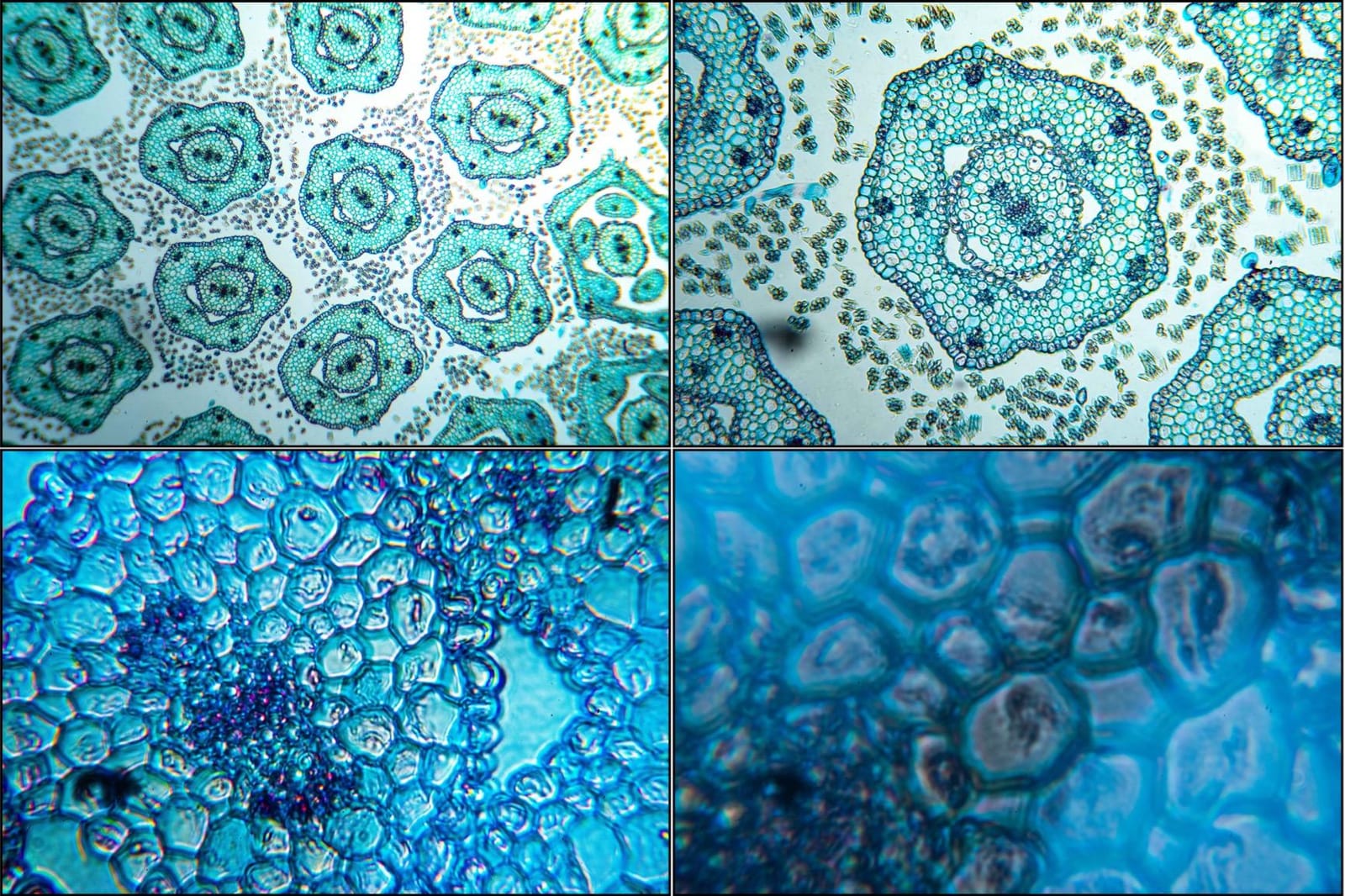 AmScope T490B Compound Trinocular Microscope, 2000X Magnification | 40X-2000X Magnification Range Compound Biological Microscope Mechanical Stage Built-In Condenser customer photo 1