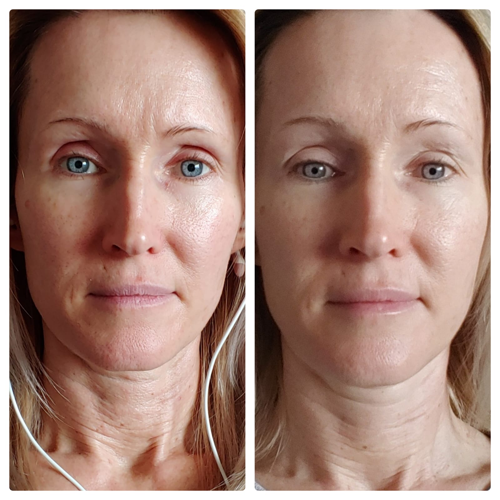 Project E Beauty Portable Rechargeable Galvanic Device | Skin Care Reduce Wrinkles Skin Tightening Firming Fine Lines Desincrustation Deep Pore Cleansing Rejuvenation Device customer photo 2