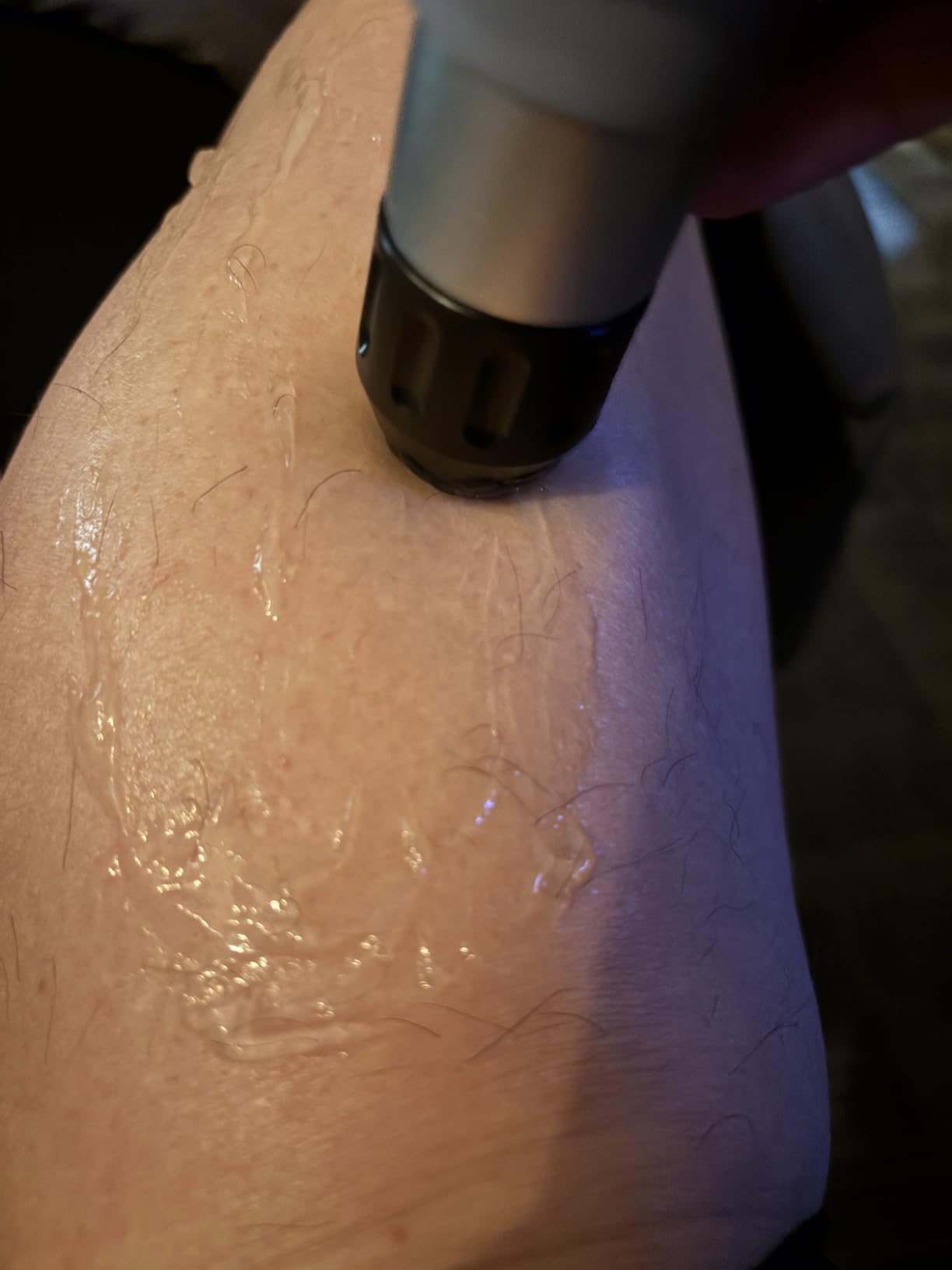 Shockwave Therapy Machine, FSA&HSA Shock Wave Therapy Device, ESWT02 | Home & Clinical Use, Joint/Muscle Pain Relief, Non-Invasive Extracorporeal Shockwave Therapy, AC 110V / 60Hz, 0.5~10 Bar customer photo 1